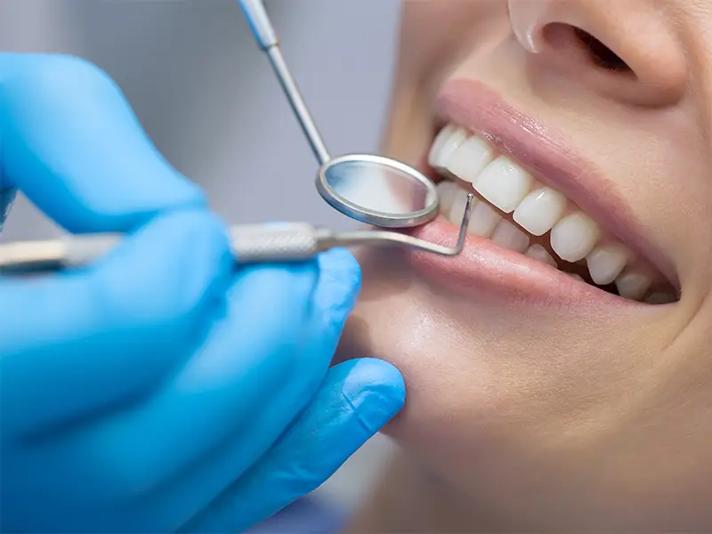 Studio dentistico Genzano - Igiene orale