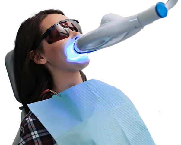 Studio dentistico Genzano - Sbiancamento